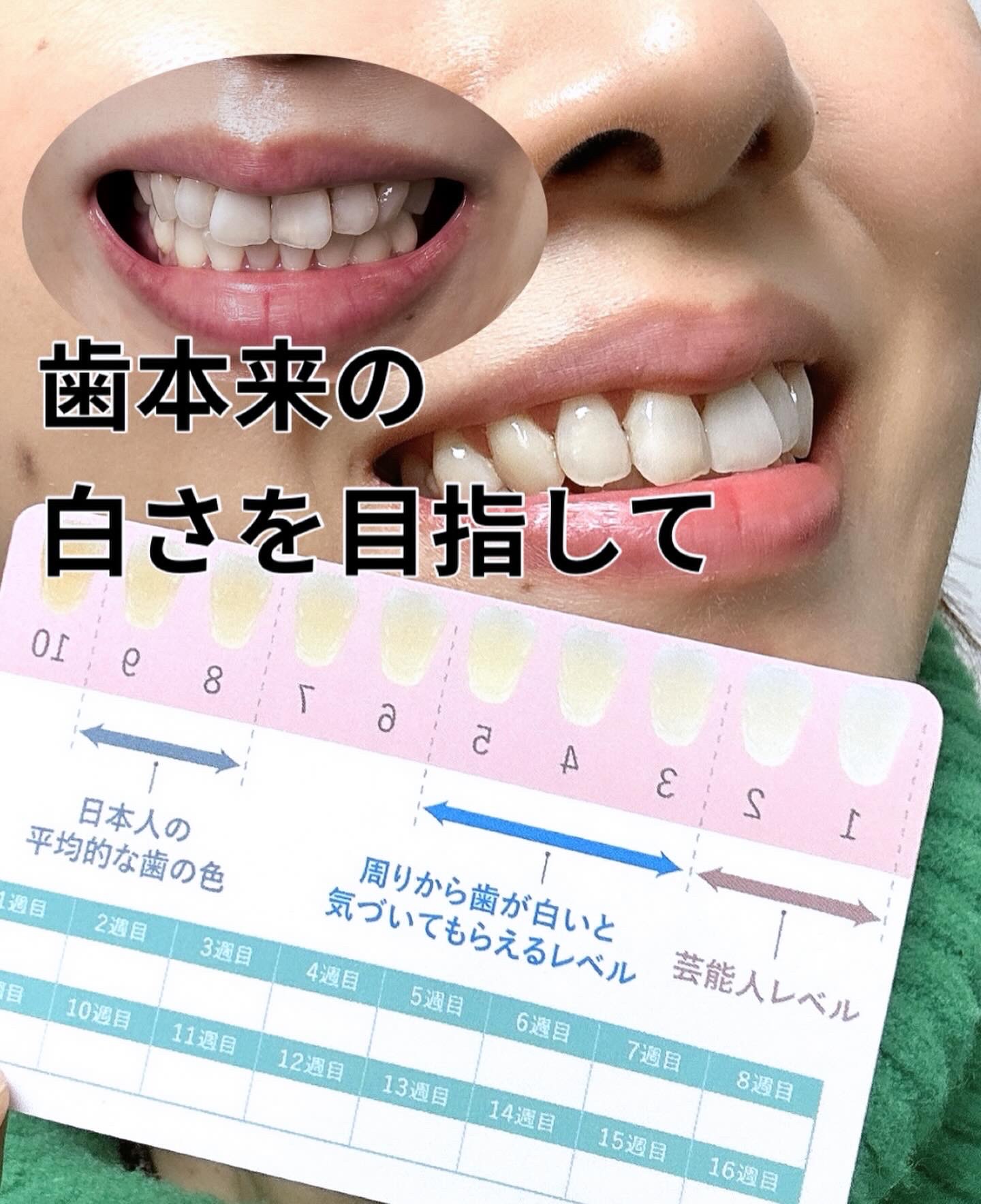 ルルホワイト/ルルシア/その他オーラルケアを使ったクチコミ（3枚目）