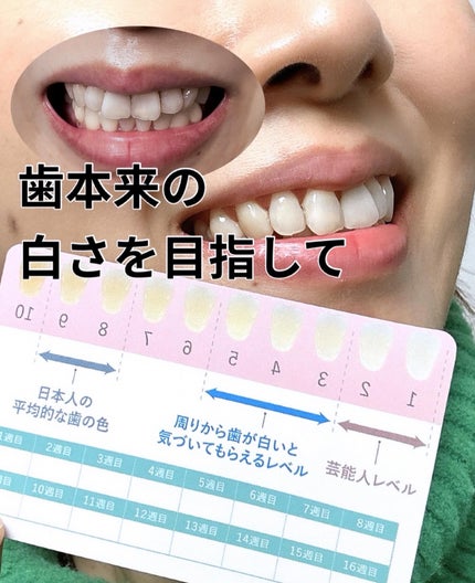 ルルホワイト/ルルシア/その他オーラルケアを使ったクチコミ(3枚目)