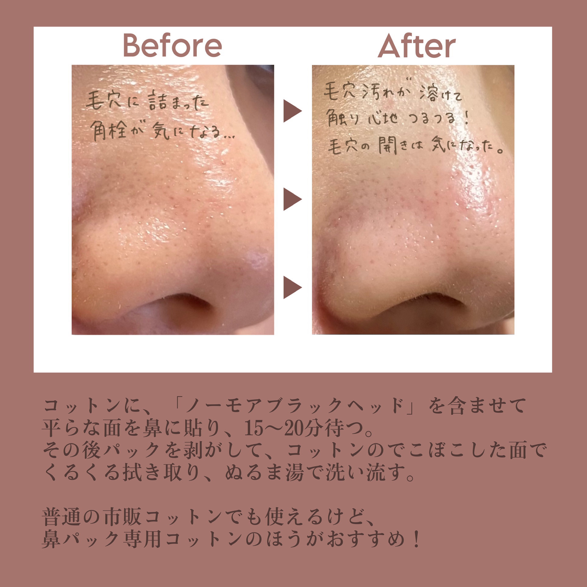 ノーモアブラックヘッド(ノーズピーリング)/One-day's you/スクラブ・ゴマージュを使ったクチコミ（2枚目）