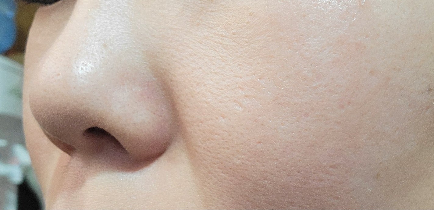 デイスキンコンフォート/excel/フェイスクリームを使ったクチコミ(2枚目)