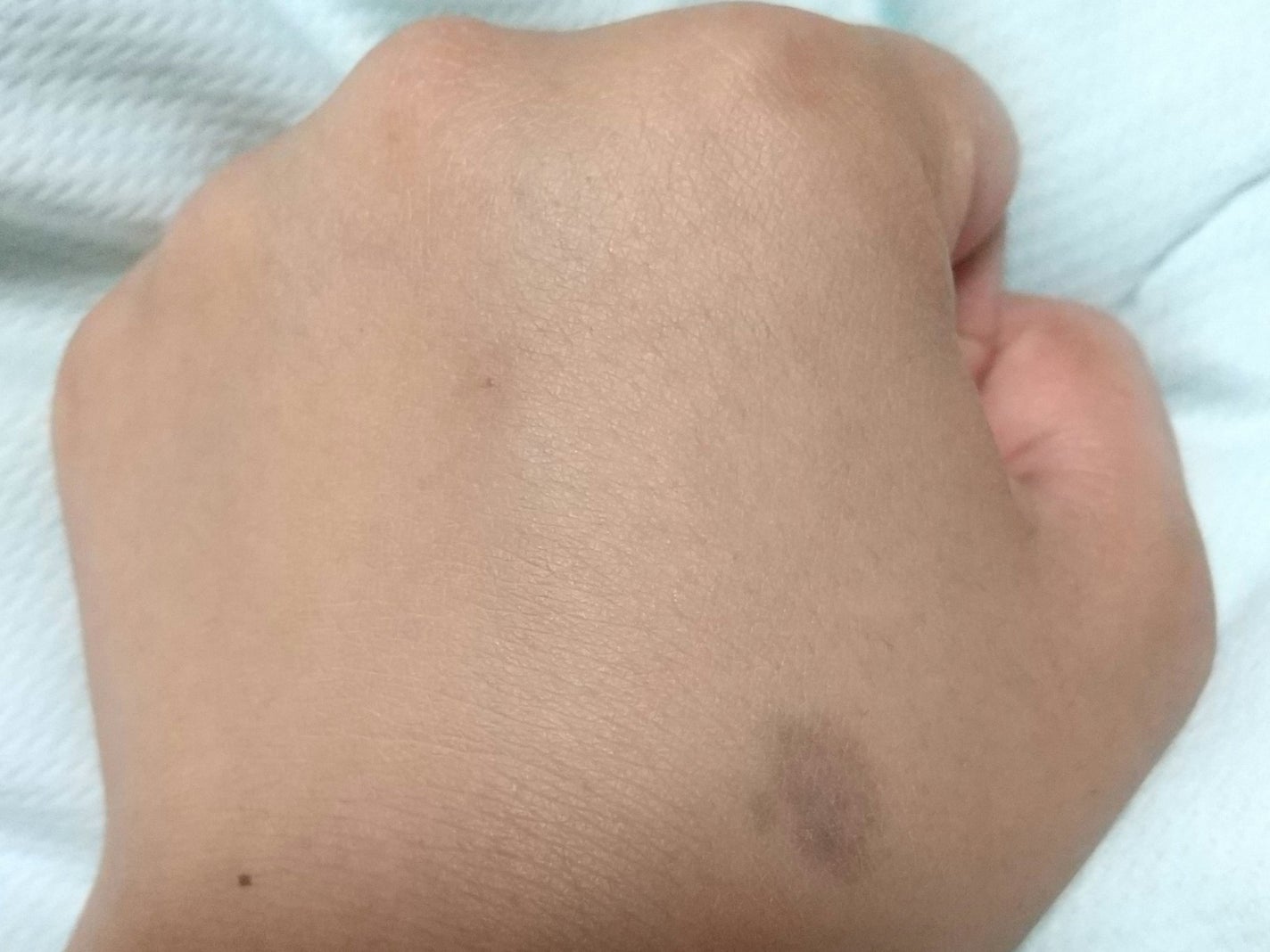 タンイドル ウルトラ ウェア リキッド N/LANCOME/リキッドファンデーションを使ったクチコミ(7枚目)