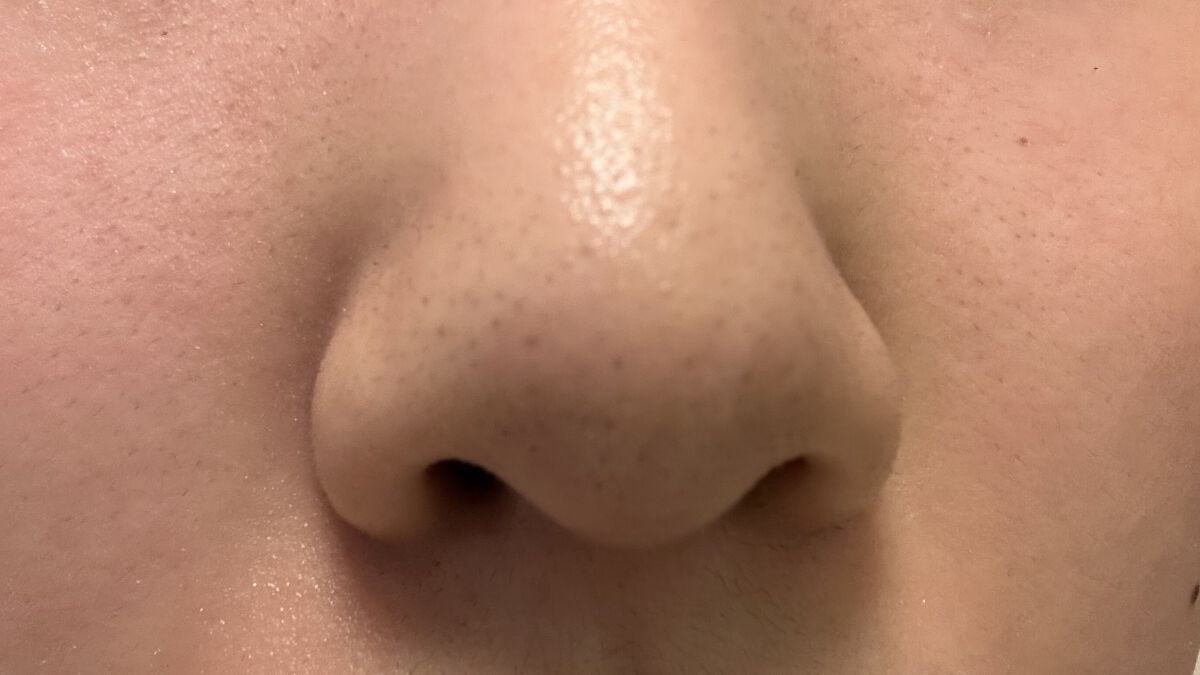 アンチポアブラックヘッドパーフェクトクリアキット/CNP Laboratory/シートマスク・パックを使ったクチコミ（3枚目）