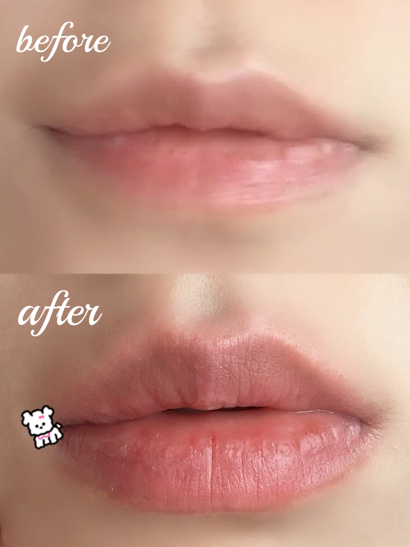 ボリュームリッププランパー/BANILA CO/リッププランパーを使ったクチコミ（1枚目）