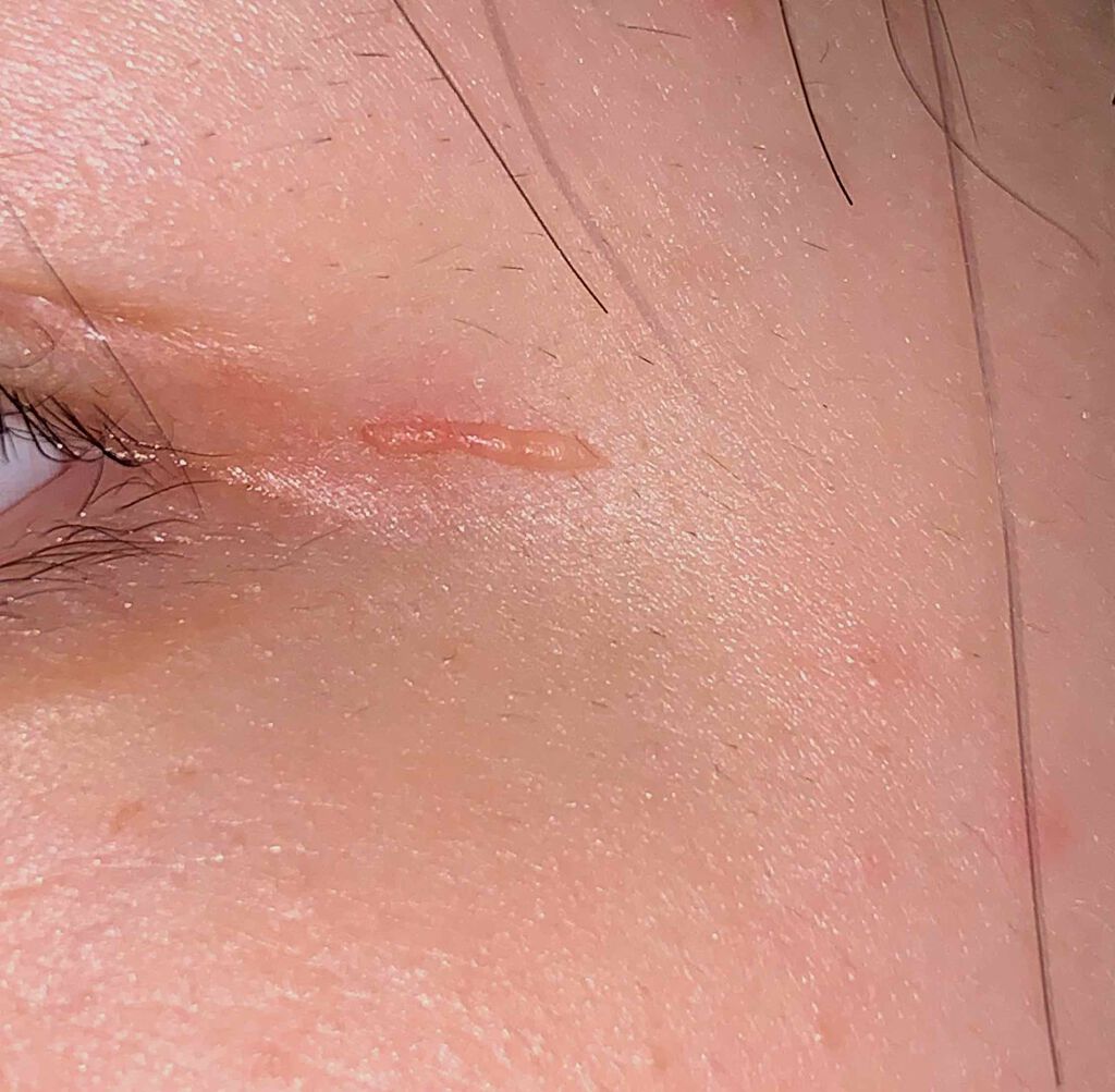 のびーるアイテープ(絆創膏タイプ、レギュラー)/DAISO/二重まぶた用アイテムを使ったクチコミ(2枚目)