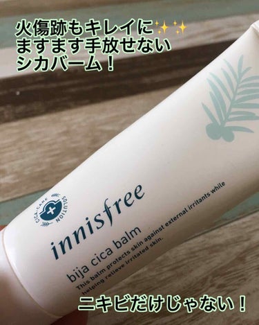 innisfree ビジャ シカバーム EXのクチコミ「先日揚げ物をしていたら腕に油がはねて💦
当日は冷やしても冷やしても痛くて‥😭
これ 跡に残った.....」（1枚目）