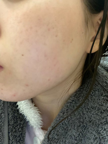 ミノン アミノモイスト ぷるぷるしっとり肌マスク/ミノン/シートマスク・パックを使ったクチコミ(4枚目)