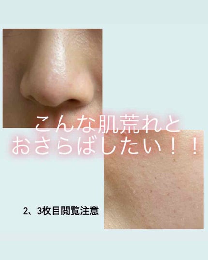 ハトムギ化粧水(ナチュリエ スキンコンディショナー R )/ナチュリエ/化粧水を使ったクチコミ(1枚目)