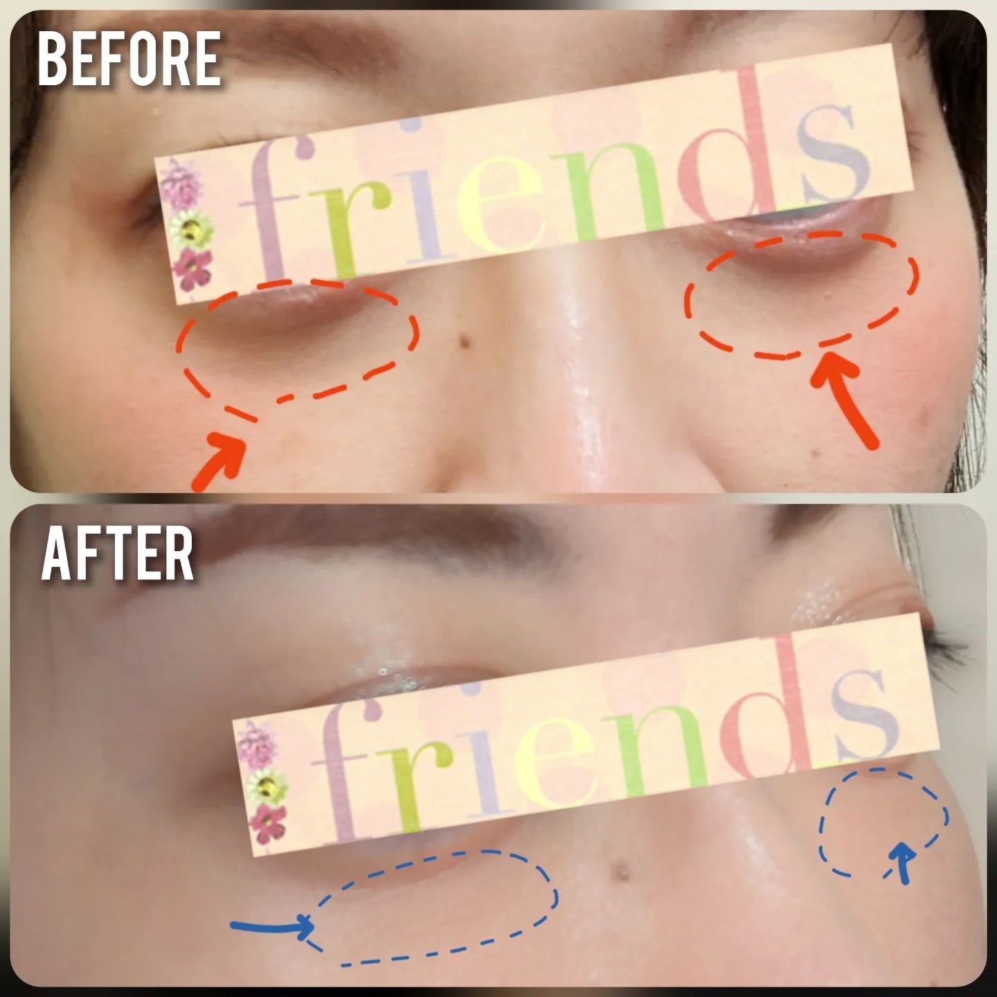 リシェ レッドトリック アイコンシーラー/Visée/パレットコンシーラーを使ったクチコミ（2枚目）