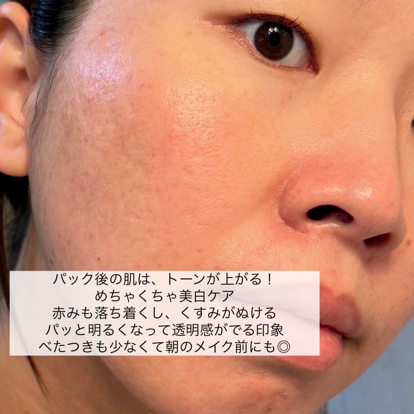 TXトーニングデイリーマスク/VT/その他スキンケアを使ったクチコミ(6枚目)