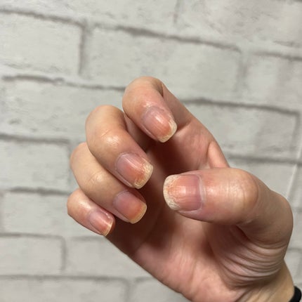 エテュセ クイックケアコート/ettusais/ネイルオイル・トリートメントを使ったクチコミ(5枚目)