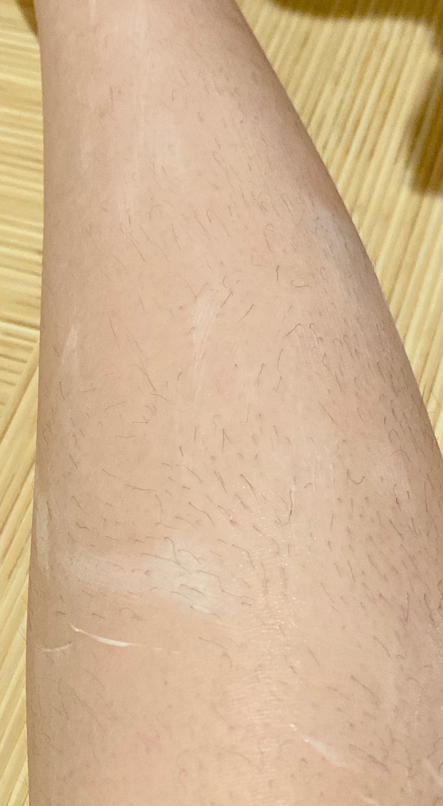 ミュゼコスメ メンズ 薬用ヘアリムーバルクリーム ホワイトシトラスの香り/ミュゼコスメ/除毛クリームを使ったクチコミ(6枚目)