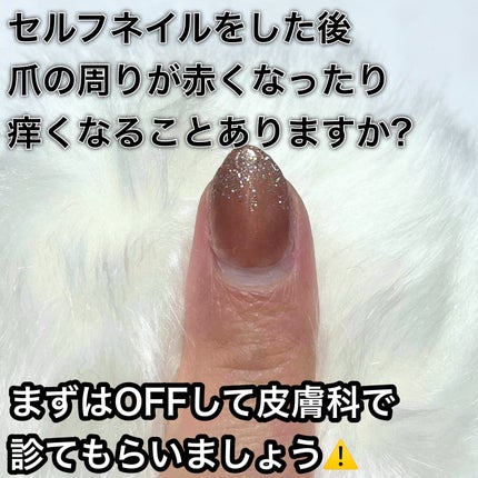 ジェルネイル(ライト対応)/セリア/ジェルネイルを使ったクチコミ(2枚目)