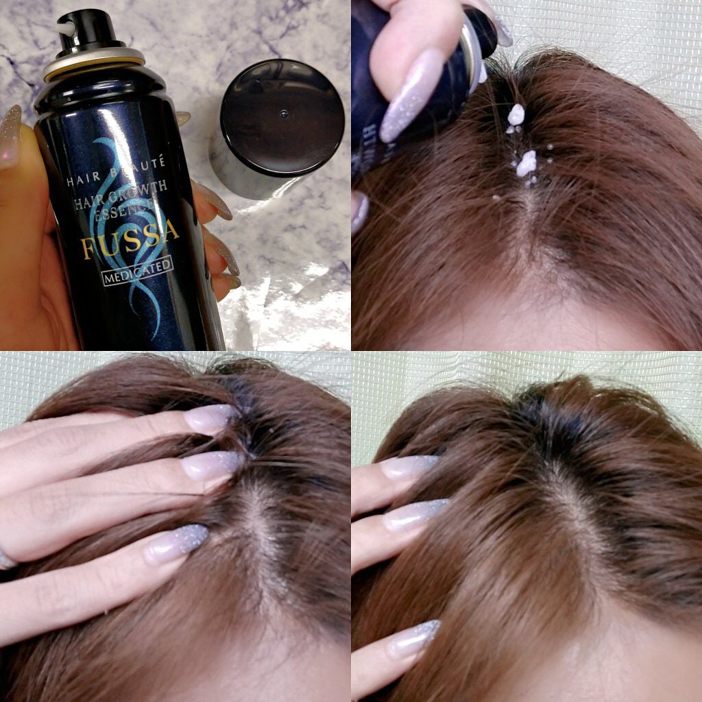 ヘアボーテ 薬用育毛エッセンス FUSSA/フューチャーラボ/頭皮ローションを使ったクチコミ(2枚目)