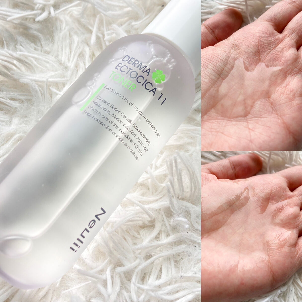 アトパインクリーム/Neulii/フェイスクリームを使ったクチコミ（2枚目）