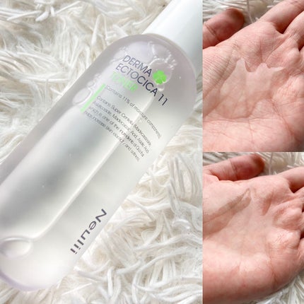 アトパインクリーム/Neulii/フェイスクリームを使ったクチコミ(2枚目)