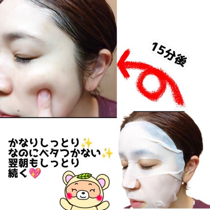 ミラクルレーザーマスクパック/トアス/シートマスク・パックを使ったクチコミ(4枚目)