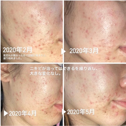 TK ローション/メナード/化粧水を使ったクチコミ(2枚目)