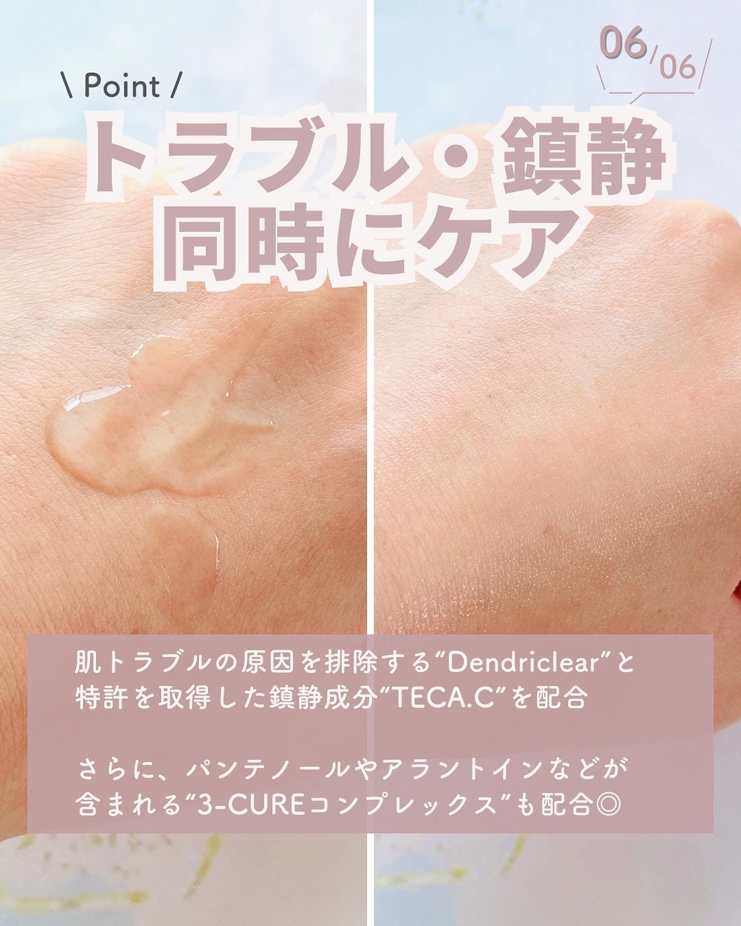 エーキュアトラブルカーミングセラム/obsero/美容液を使ったクチコミ(7枚目)