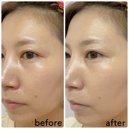 メイクヒール1.P.L ファンデーザー/SPF20 PA++/MAKEHEAL/リキッドコンシーラーを使ったクチコミ(5枚目)