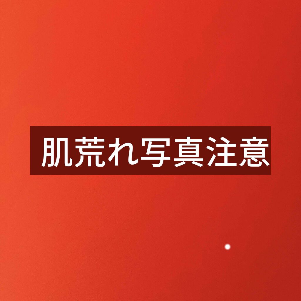 メイクリタッチパレット/KiSS/パレットコンシーラーを使ったクチコミ（2枚目）