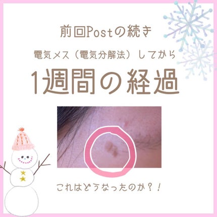 を使ったクチコミ(2枚目)