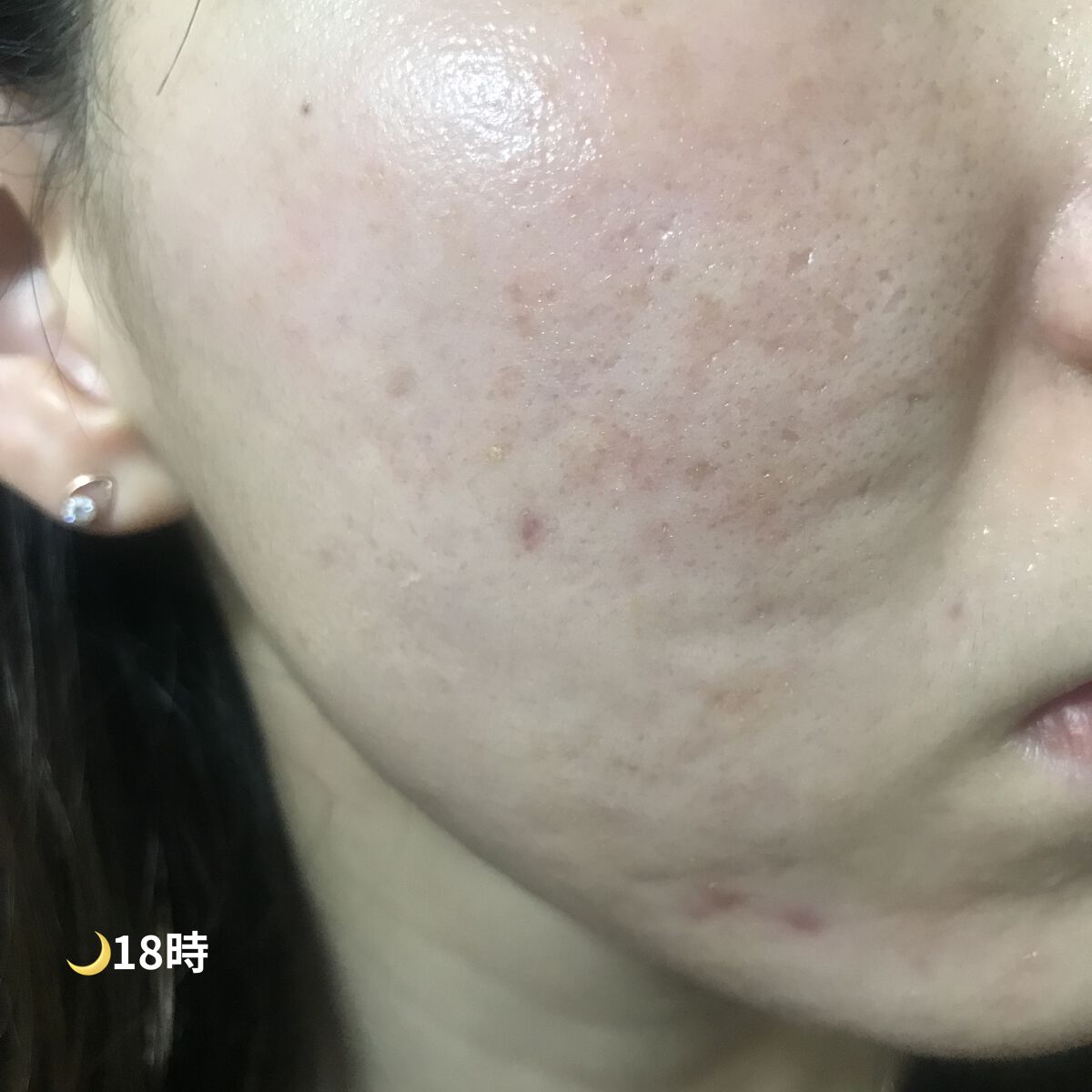 スティック美容液(CICA)/ネイチャーリパブリック/フェイスバームを使ったクチコミ（3枚目）