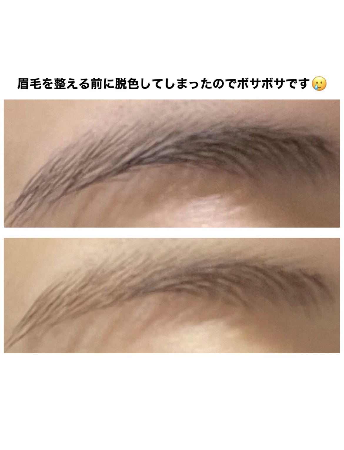 脱色クリーム 敏感肌用/エピラット/ムダ毛ケアを使ったクチコミ（3枚目）