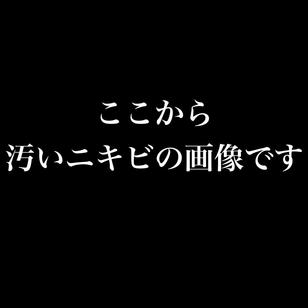 ジョンソンベビーオイル微香性/ジョンソンベビー/ボディオイルを使ったクチコミ(2枚目)