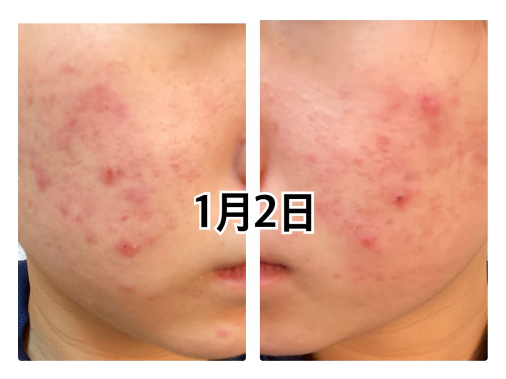 ビューティ スリープ/ラッシュ/洗い流すパック・マスクを使ったクチコミ（1枚目）