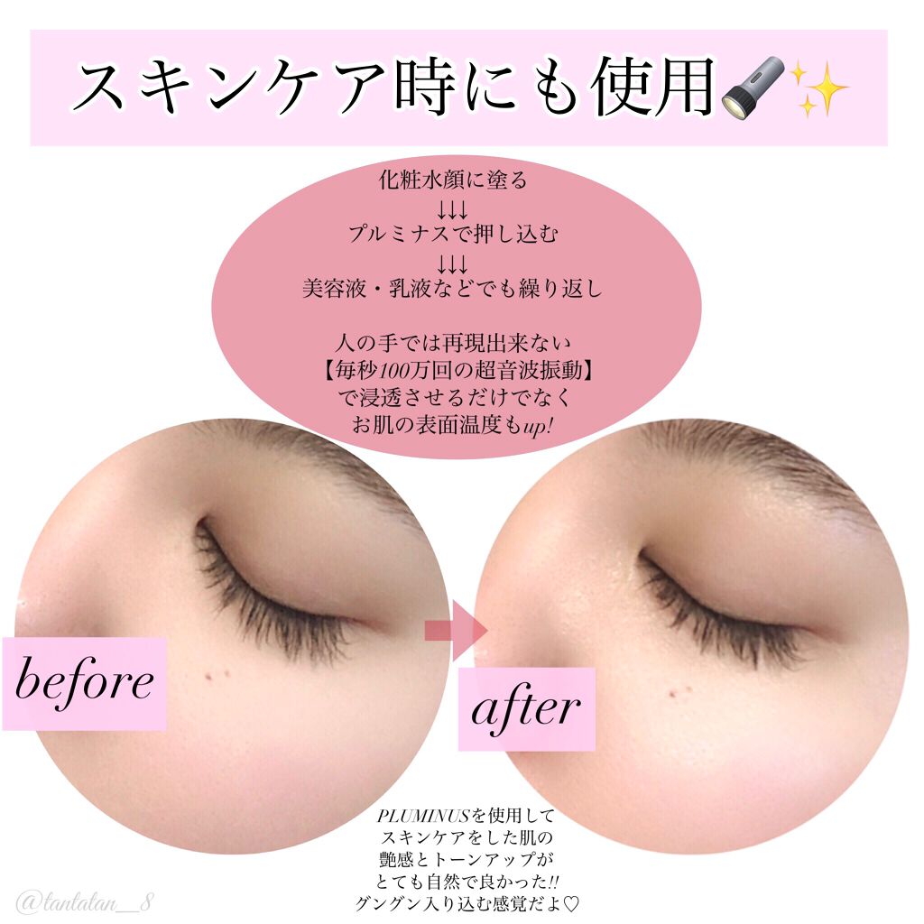 PLUMINUS/mous./美顔器・マッサージを使ったクチコミ（3枚目）