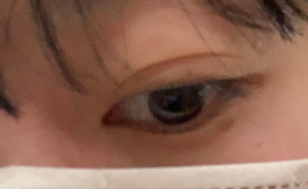 な on LIPS 「初投稿です。助けてください教えていただきたいです。昔から目にシ..」(2枚目)