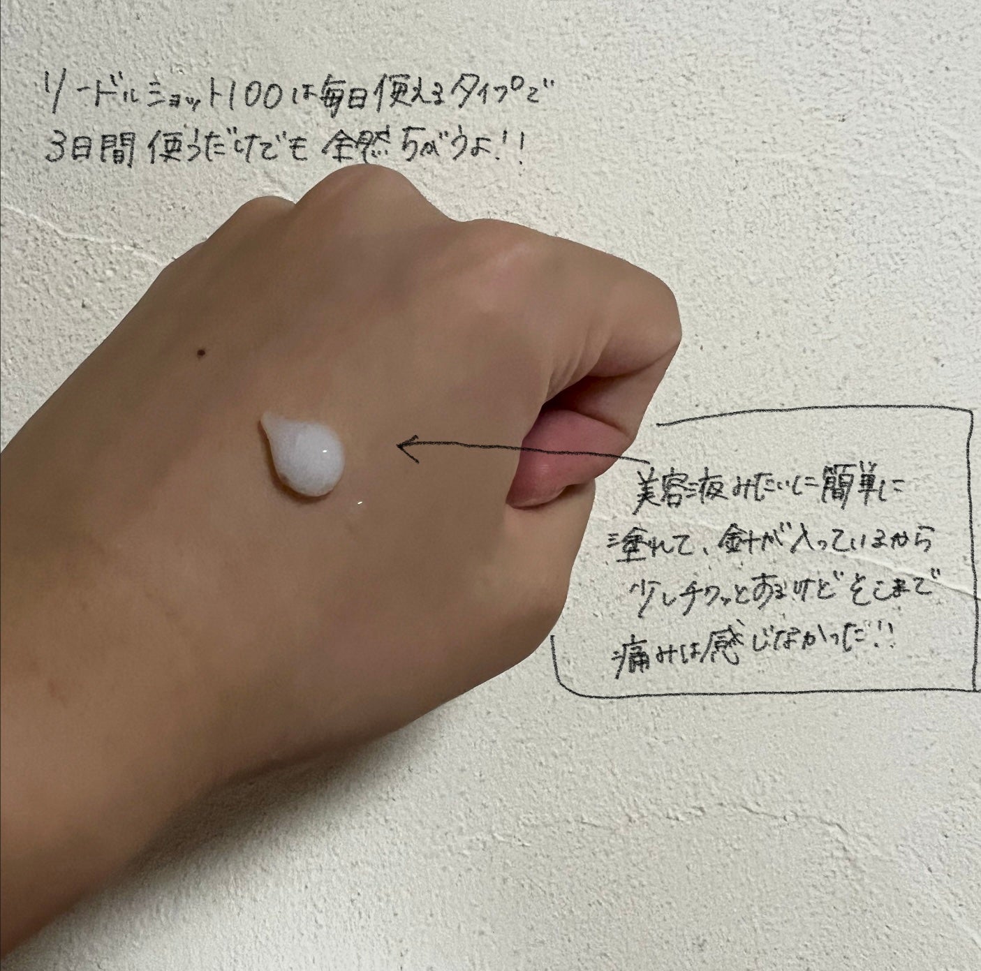 シカレチA エッセンス0.1/VT/美容液を使ったクチコミ(3枚目)