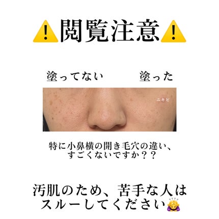 ムーンプレストブライトパウダー/KATE/プレストパウダーを使ったクチコミ(7枚目)