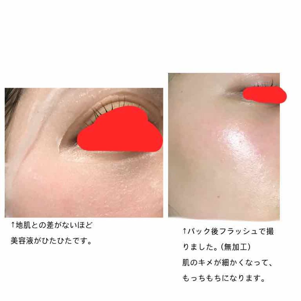N.M.FアクアアンプルマスクJEX/MEDIHEAL/シートマスク・パックを使ったクチコミ（2枚目）