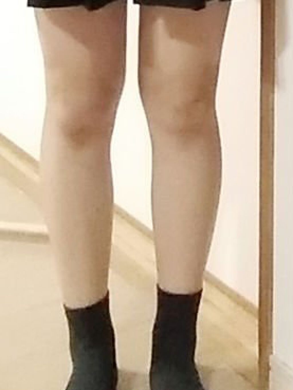 寝ながらメディキュット ロング/メディキュット/着圧ソックス・レギンスを使ったクチコミ（3枚目）