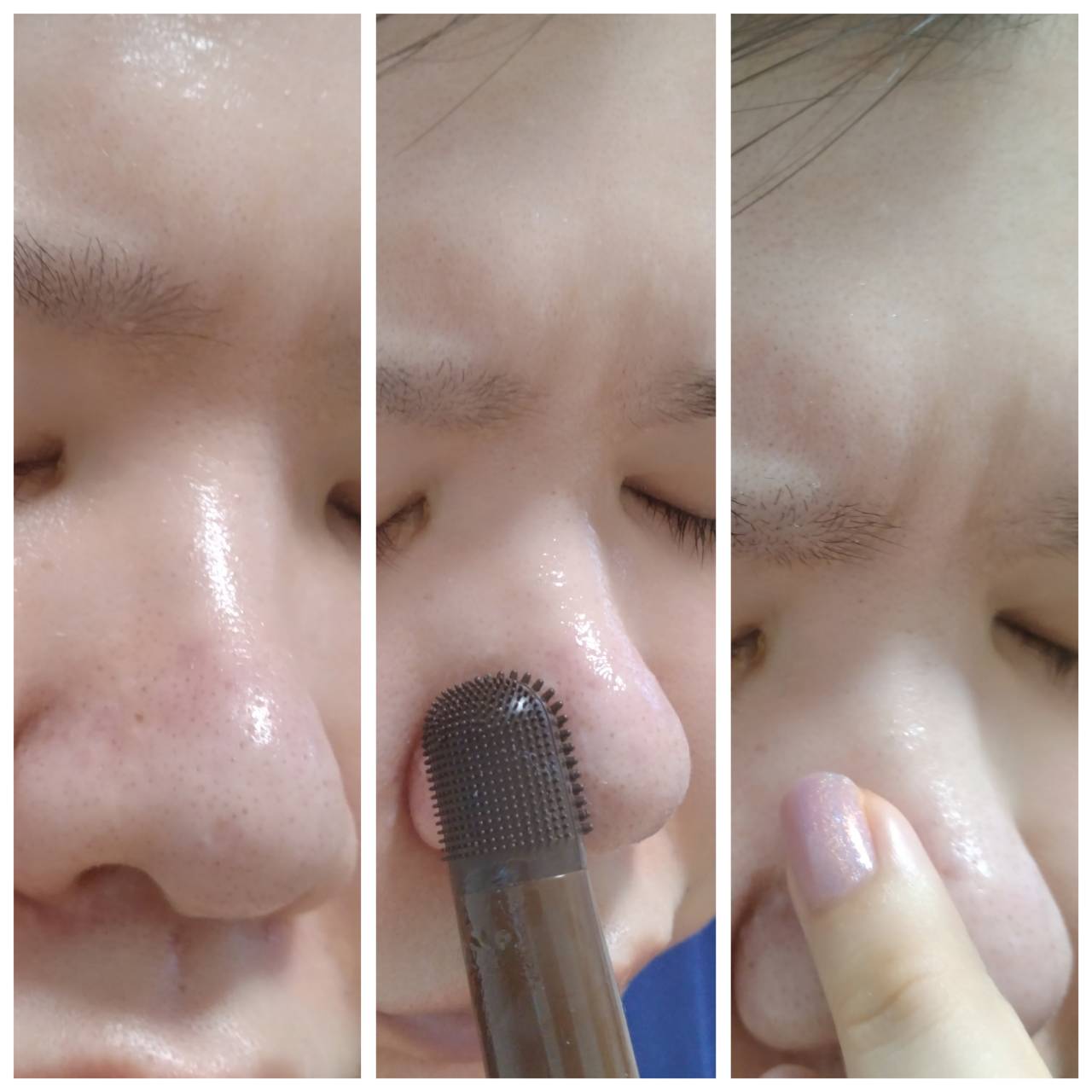 チョコブラ スペシャル毛穴ケアセット/Chocobra/スキンケアキットを使ったクチコミ（3枚目）