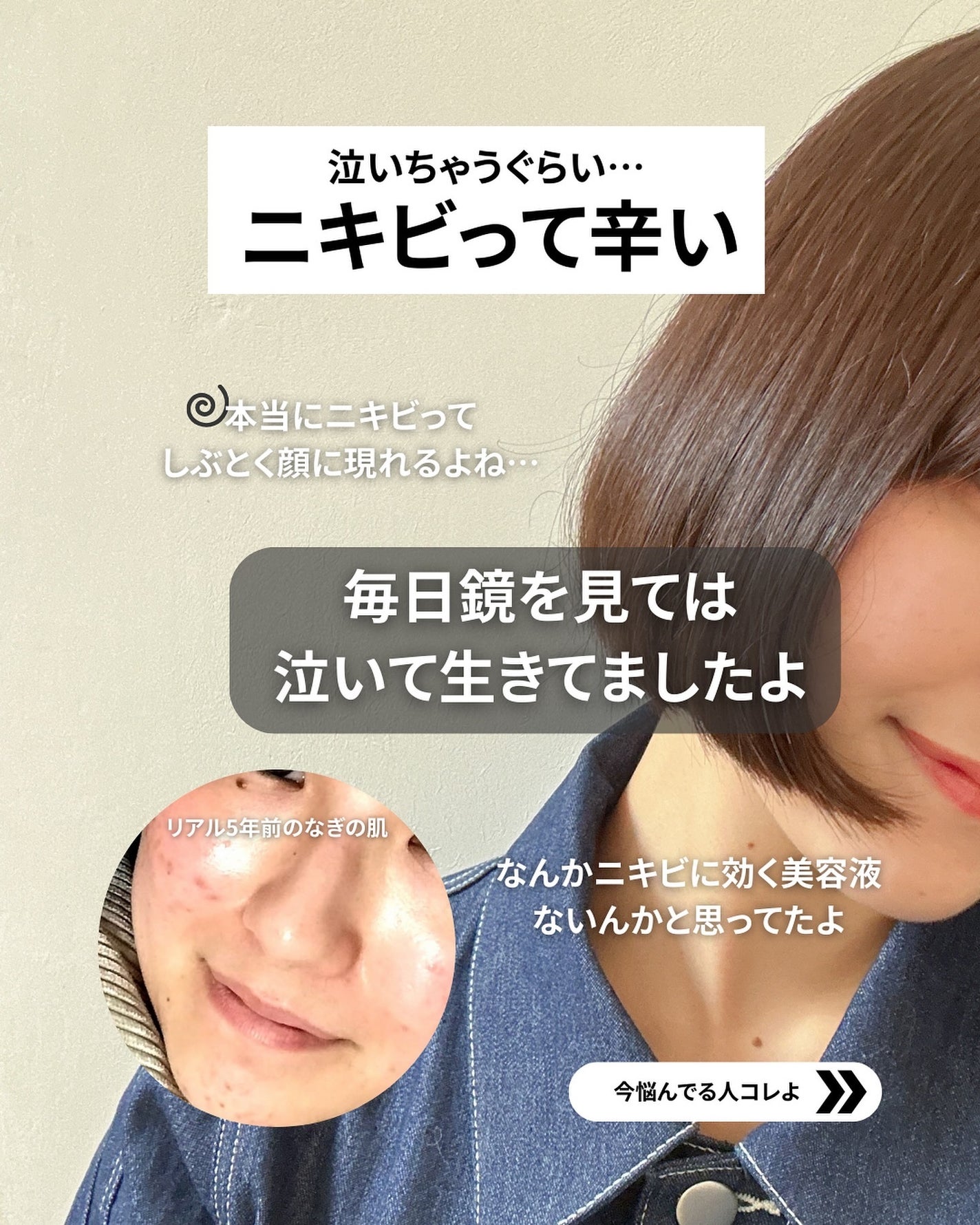 ノスカナイン トラブル セラム/FATION/美容液を使ったクチコミ(2枚目)