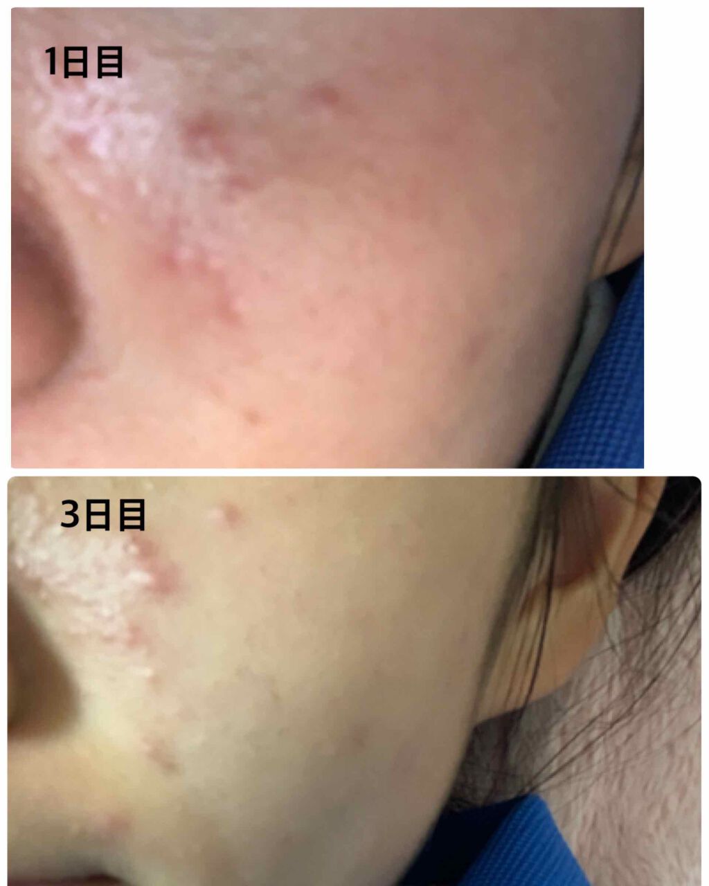 を使ったクチコミ（1枚目）