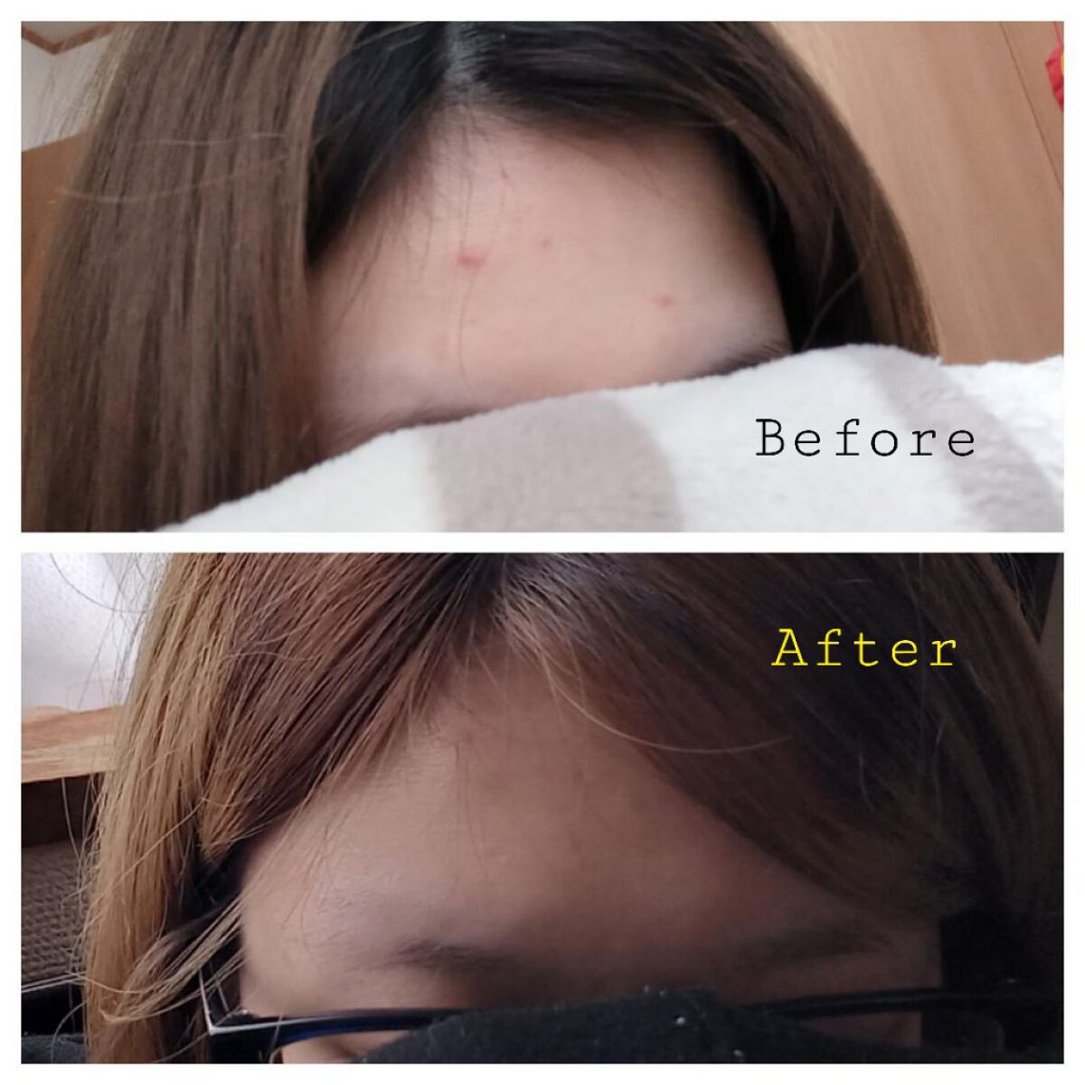 リアルカロテンブレミッシュクリアセラム/APRILSKIN/美容液を使ったクチコミ（2枚目）