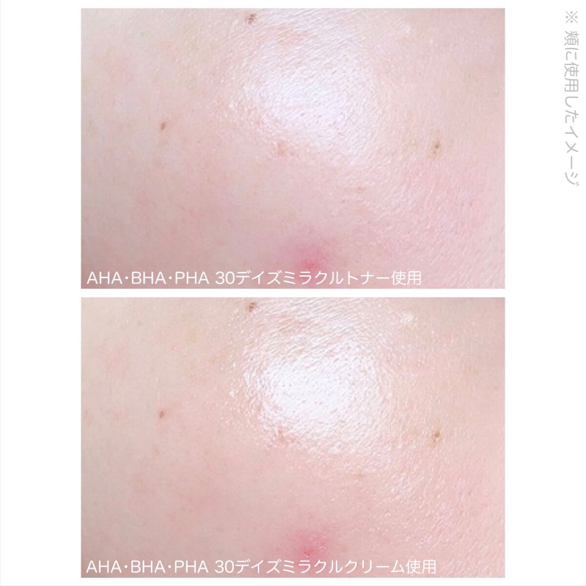 AHA·BHA·PHA 30デイズミラクルトナー/SOME BY MI/化粧水を使ったクチコミ(10枚目)