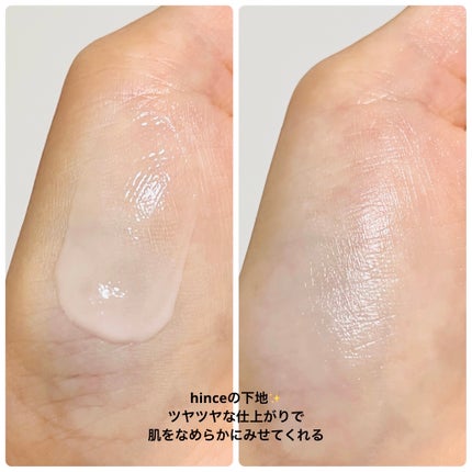 ティーツリーケア ソリューション エッセンシャルマスクEX/MEDIHEAL/シートマスク・パックを使ったクチコミ(10枚目)