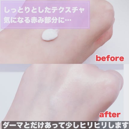 ダーマセプトRX AZAセラム/ダーマセプトRX/美容液を使ったクチコミ(3枚目)