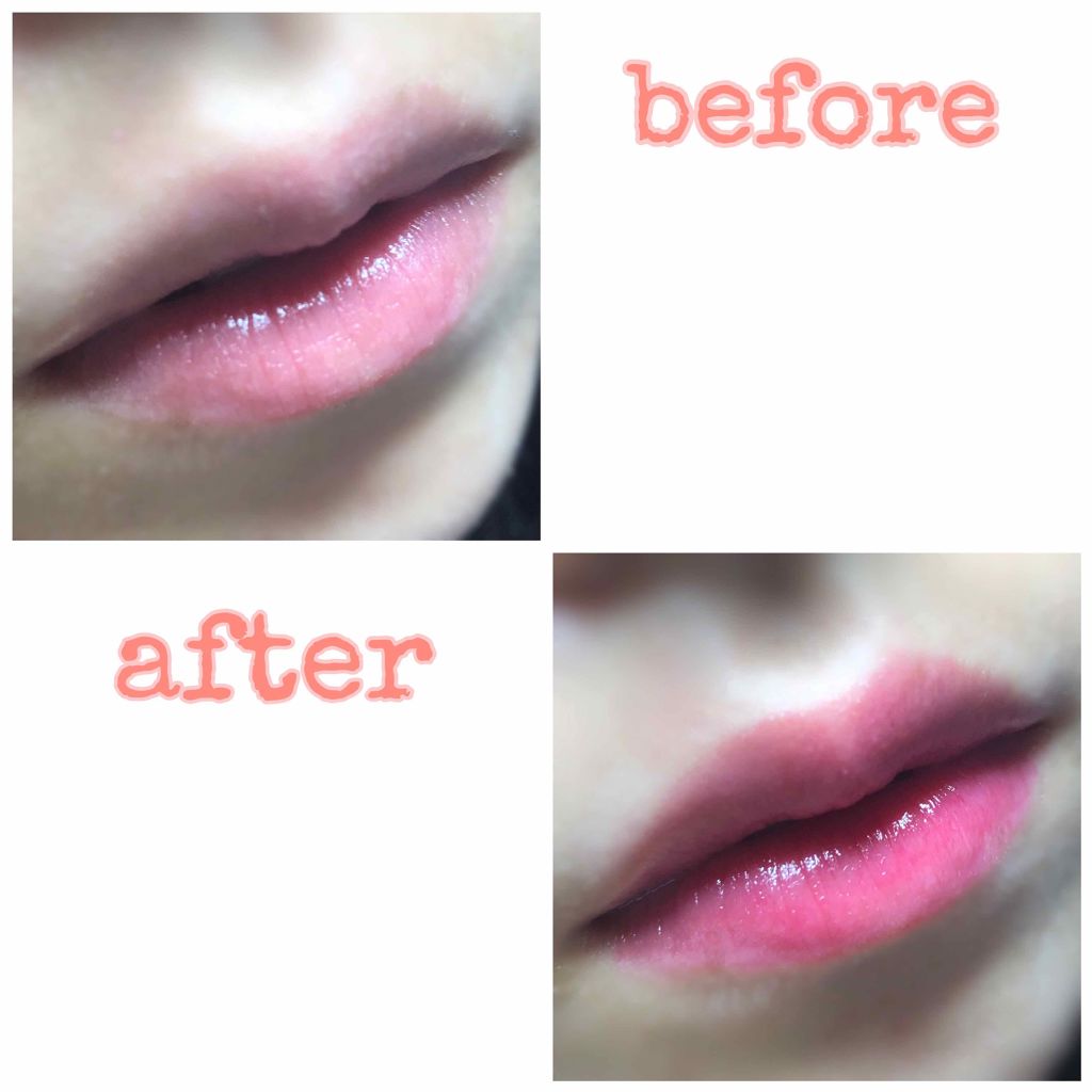 ディアダーリン オイルティント/ETUDE/リップグロスを使ったクチコミ（2枚目）