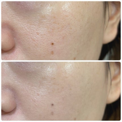 フィットグロウクッション/キャンメイク/クッションファンデーションを使ったクチコミ(5枚目)