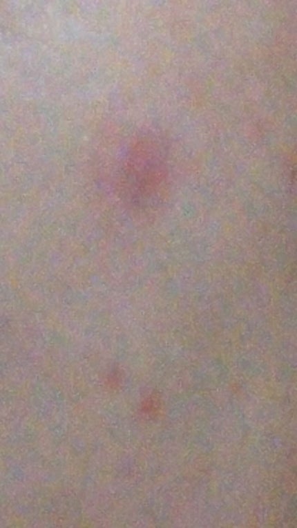 VCスターターセット/VCシリーズ/スキンケアキットを使ったクチコミ(4枚目)