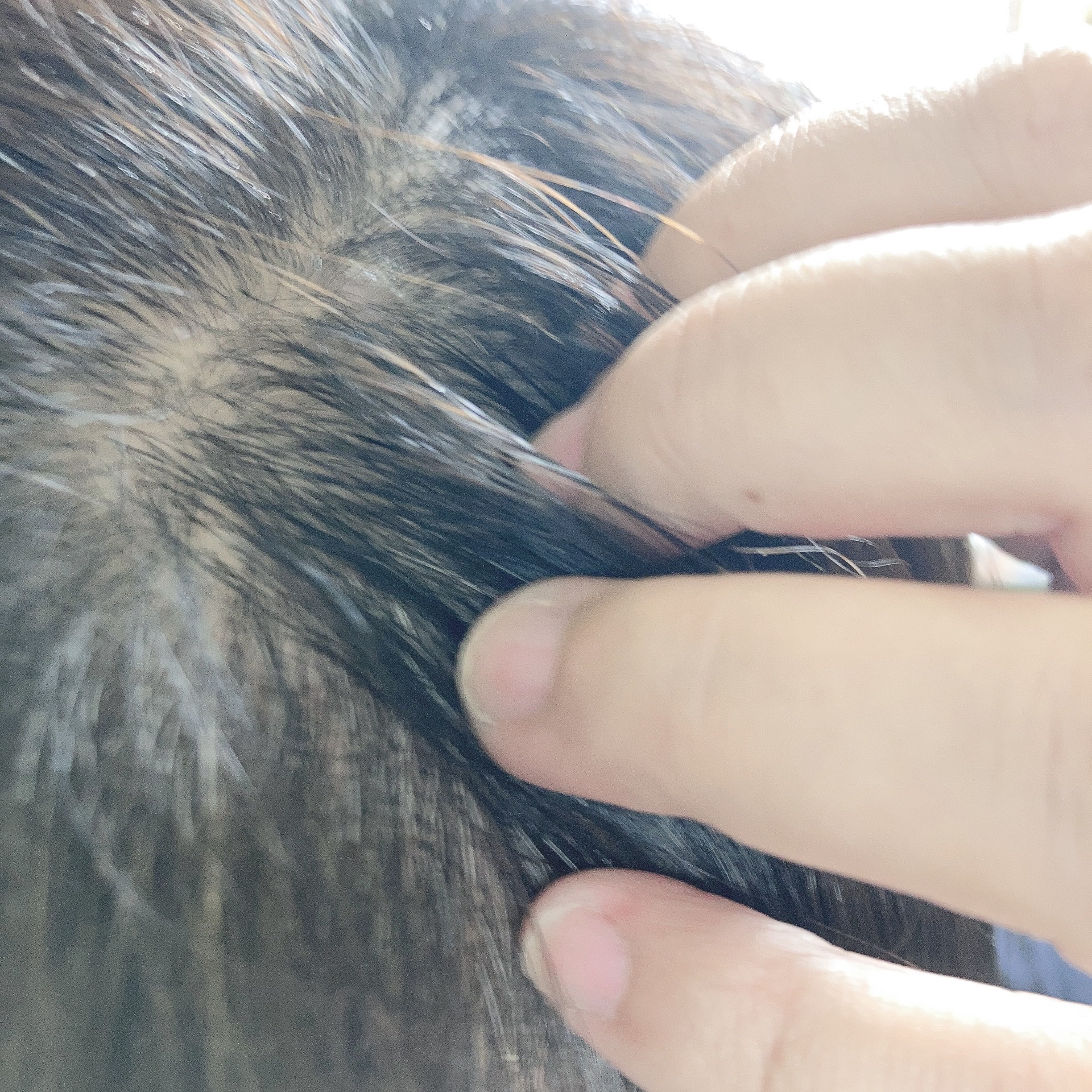 試してみた】オム メディケイテッド スカルプエッセンス La