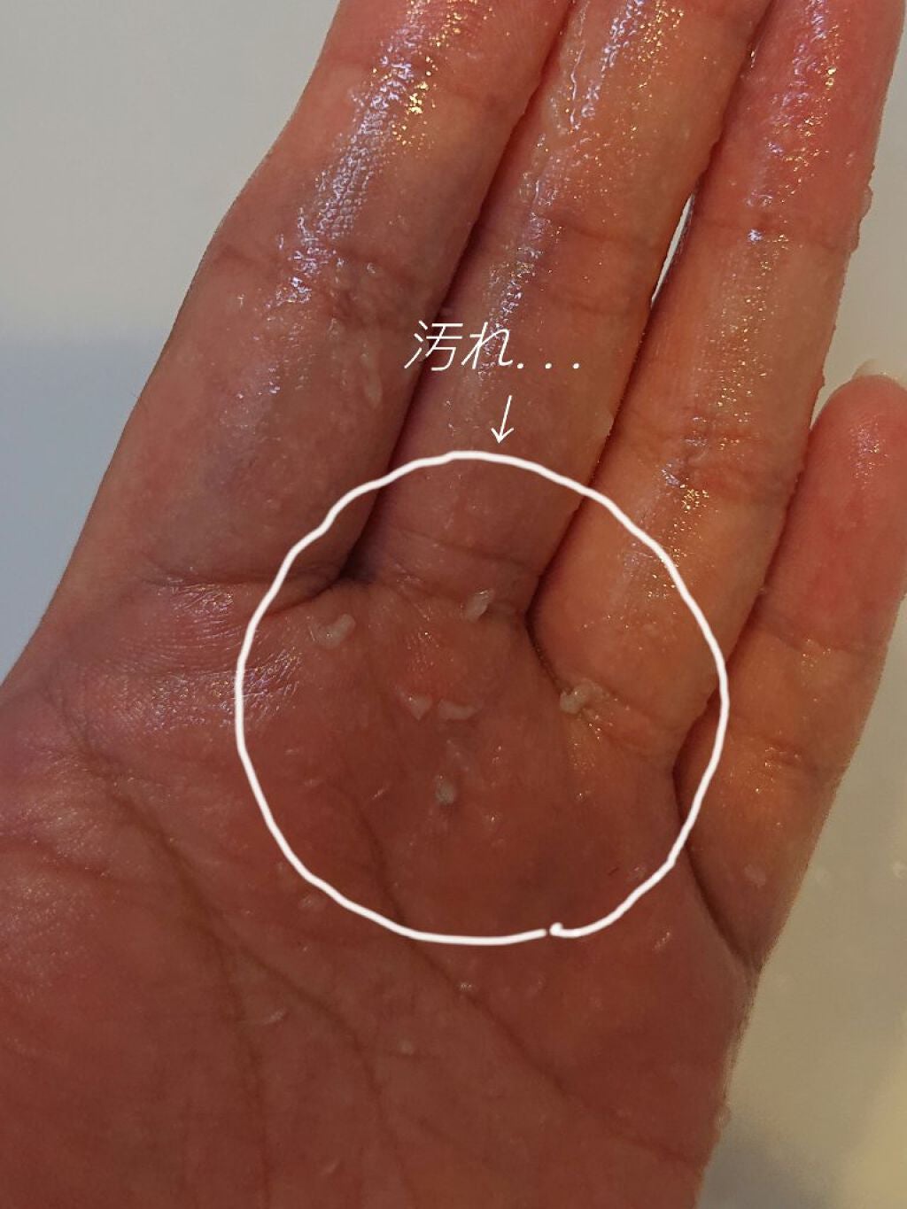 DETクリア ブライト&ピール ピーリングジェリー<ホット>/Detclear/ピーリングを使ったクチコミ(4枚目)