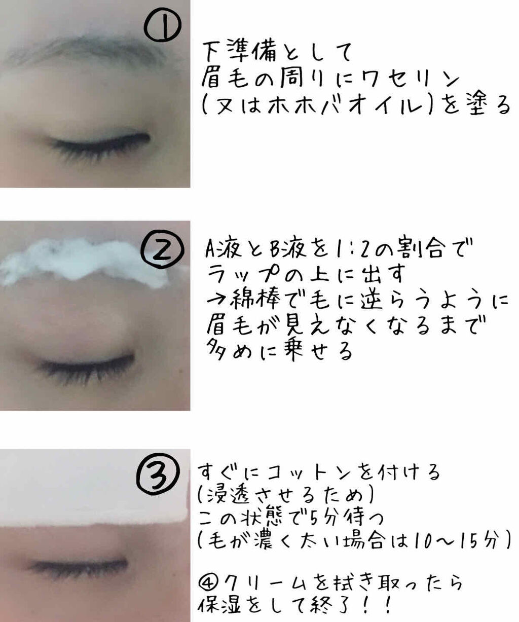 脱色クリーム スピーディー/エピラット/ムダ毛ケアを使ったクチコミ（3枚目）