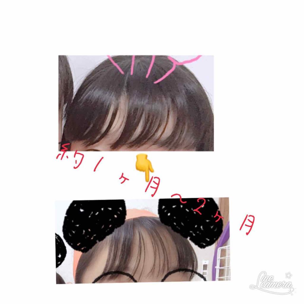 ひな on LIPS 「☏昔は重くてガタガタでくせ毛だったのがコンプレックスでした。そ..」(1枚目)