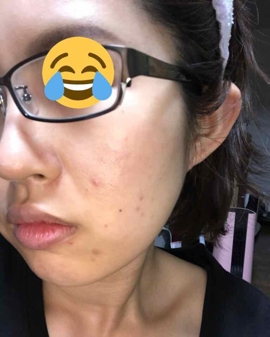 大豆イソフラボン 吸収型/DHC/健康サプリメントを使ったクチコミ(2枚目)